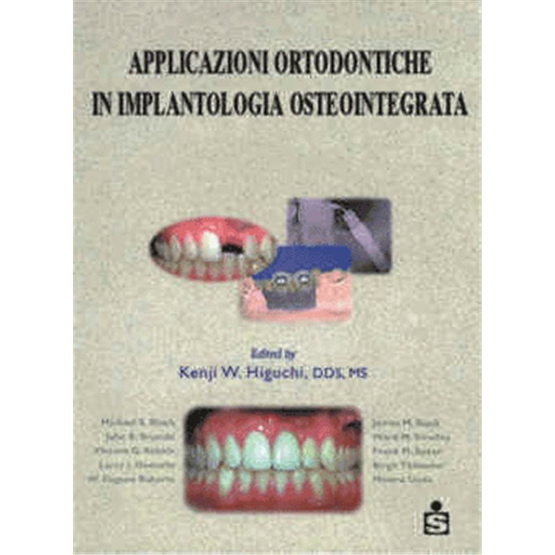 Applicazioni ortodontiche in implantologia osteointegrata